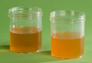 Stearated sealer and seal coat samples in jar